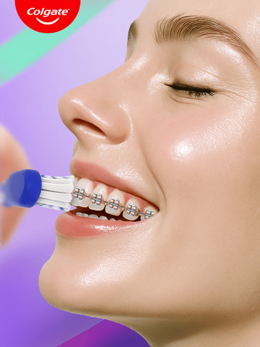 Зубная щетка COLGATE Ortho для брекетов, мягкая, картинка