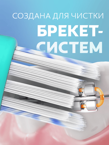 Зубная щетка COLGATE Ortho для брекетов, мягкая, фотография