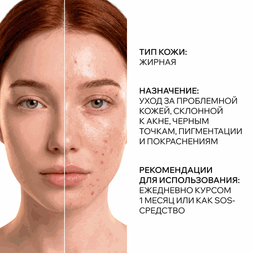Крем-корректор ARAVIA LABORATORIES Azelaic correcting cream азелаиновый, 50мл, фотография