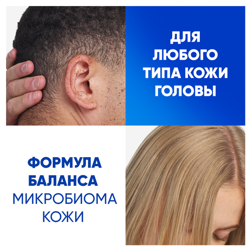 Шампунь HEAD&SHOULDERS Яблочная свежесть, против перхоти, 600мл, крупный план