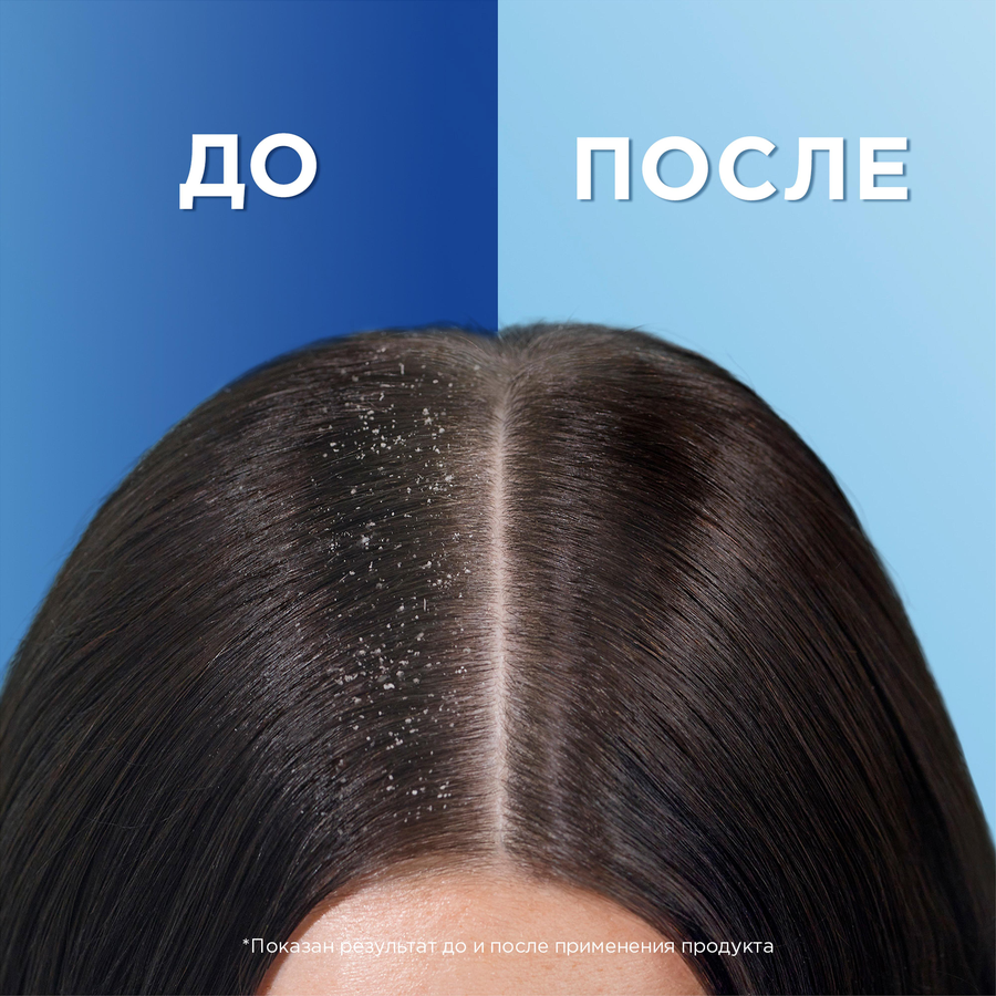 Шампунь против перхоти HEAD&SHOULDERS Объем от самых корней, 400мл, превью